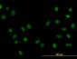 FOXA1 Antibody (monoclonal) (M05)