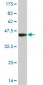 FOXA1 Antibody (monoclonal) (M05)