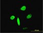 FOXA2 Antibody (monoclonal) (M12)