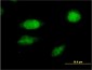 FOXC2 Antibody (monoclonal) (M02)