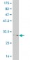 FOXL1 Antibody (monoclonal) (M03)