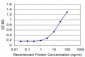 FOXO1A Antibody (monoclonal) (M02)