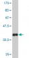 FOXO1A Antibody (monoclonal) (M02)