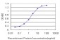 FOXO3A Antibody (monoclonal) (M13)