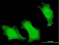 FOXO3A Antibody (monoclonal) (M13)