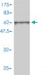 FRS2 Antibody (monoclonal) (M02)