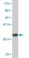 FRZB Antibody (monoclonal) (M02)