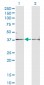 FST Antibody (monoclonal) (M01A)