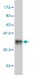 FTCD Antibody (monoclonal) (M01)