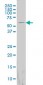 FTCD Antibody (monoclonal) (M01)