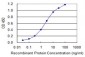 FTCD Antibody (monoclonal) (M02)