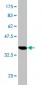 FTCD Antibody (monoclonal) (M02)