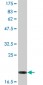 FTL Antibody (monoclonal)