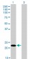 FUSIP1 Antibody (monoclonal) (M03)