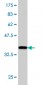 FUSIP1 Antibody (monoclonal) (M07)