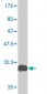 FZD2 Antibody (monoclonal) (M01)