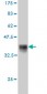 FZD5 Antibody (monoclonal) (M01)