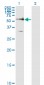 FZD5 Antibody (monoclonal) (M01)