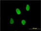 G22P1 Antibody (monoclonal) (M01)