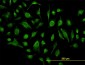 GABBR1 Antibody (monoclonal) (M01)