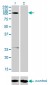 GABBR1 Antibody (monoclonal) (M01)