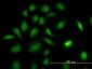 GART Antibody (monoclonal) (M01)