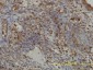 GART Antibody (monoclonal) (M01)