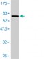 GART Antibody (monoclonal) (M01)