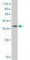 GATAD2A Antibody (monoclonal) (M01)