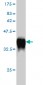 GCH1 Antibody (monoclonal) (M01)