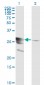 GCH1 Antibody (monoclonal) (M01)
