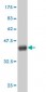 GCLC Antibody (monoclonal) (M01)