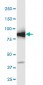GCLC Antibody (monoclonal) (M01)
