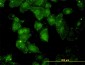 GCLC Antibody (monoclonal) (M01)