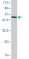 GCLM Antibody (monoclonal) (M01)