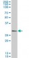 GCLM Antibody (monoclonal) (M01)