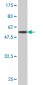 GCLM Antibody (monoclonal) (M02)