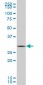GCLM Antibody (monoclonal) (M02)