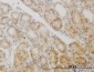 GCM1 Antibody (monoclonal) (M05)