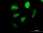 GCM1 Antibody (monoclonal) (M06)