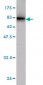 GDI1 Antibody (monoclonal) (M08)