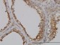 GGT1 Antibody (monoclonal) (M01)