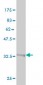 GGT1 Antibody (monoclonal) (M01)