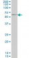 GGT1 Antibody (monoclonal) (M01)