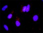 GHR Antibody (monoclonal) (M01)