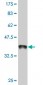 GHRL Antibody (monoclonal) (M09)