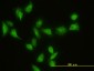 GIT2 Antibody (monoclonal) (M01)