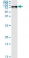 GLB1 Antibody (monoclonal) (M01)