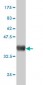 GLB1 Antibody (monoclonal) (M01)