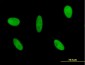 GLI3 Antibody (monoclonal) (M01)